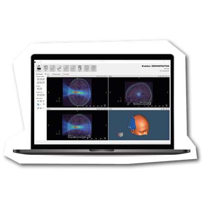 k-Plan Ultrasound Planning