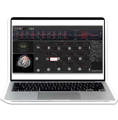 Satori fNIRS Software